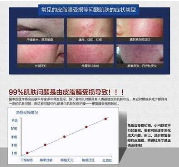 為什么你的臉容易過敏？